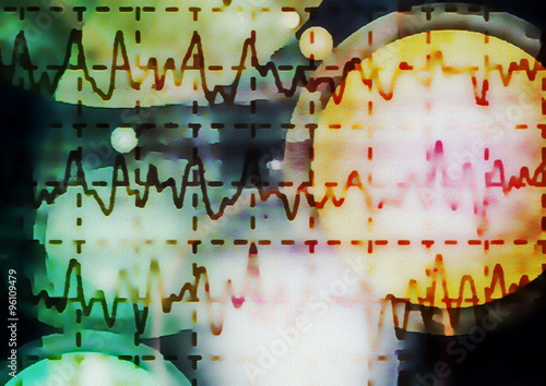 brain wave on electroencephalogram EEG for epilepsy, illustration photo