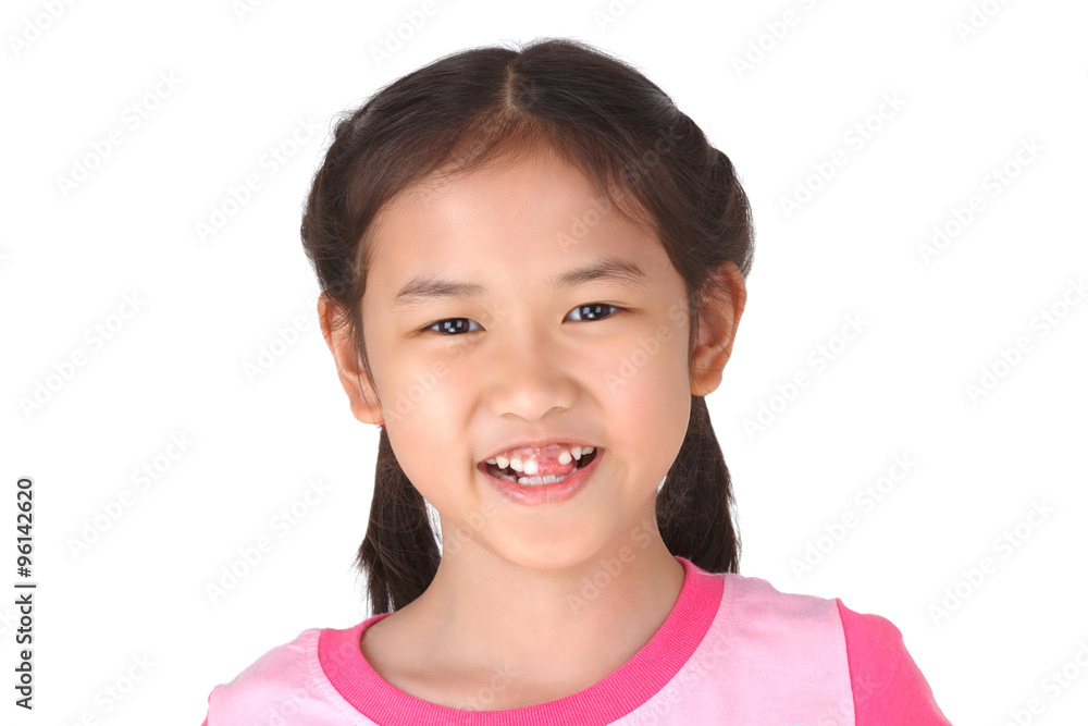 Little cute girl smile with her broken tooth and sticking the t Little cute girl smile with her broken tooth and sticking the t