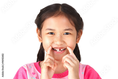 Little cute girl smile with her  broken tooth. white background.