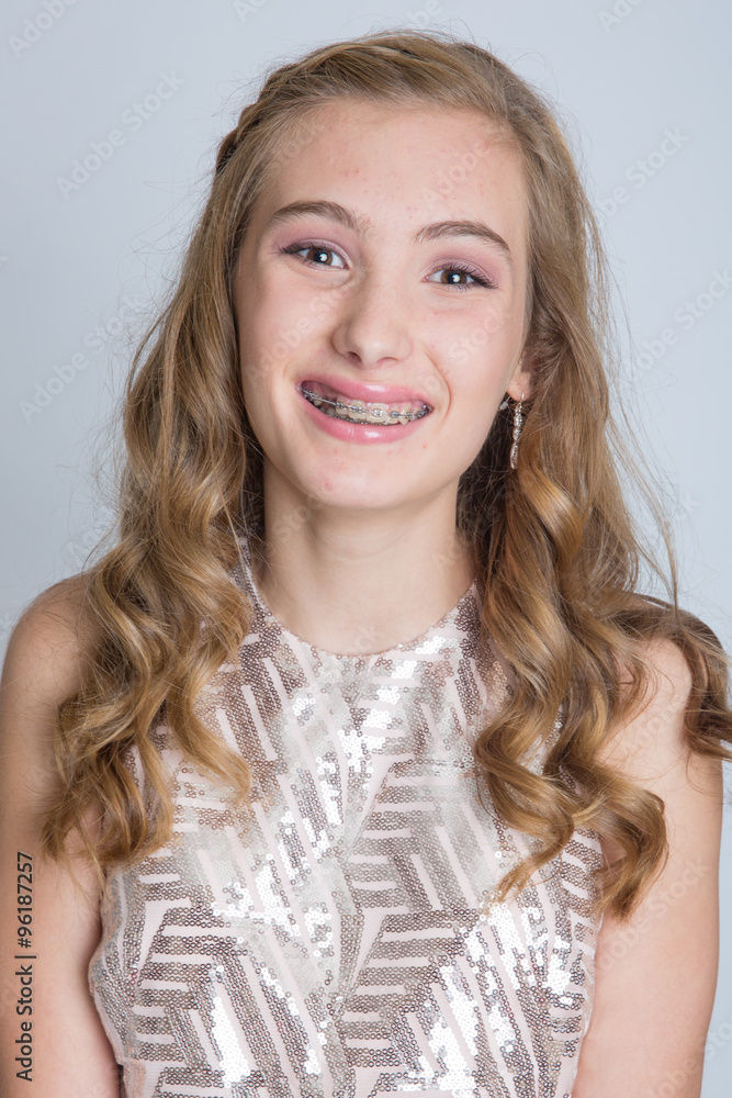 teenage girl with braces teenage girl with braces