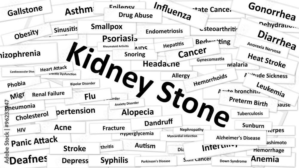 Fototapeta premium Kidney Stone