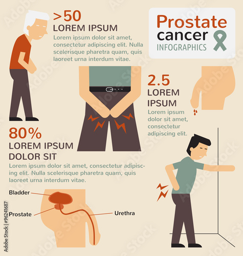 Prostate cancer infographics