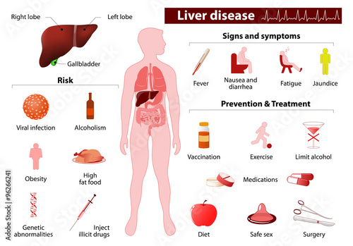 liver disease. Medical infographic