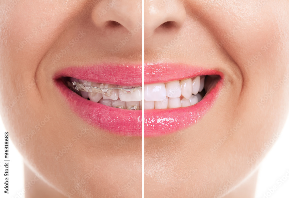 Naklejka premium Healthy woman teeth