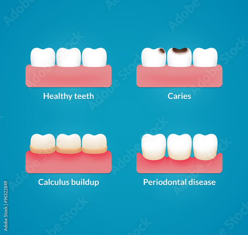 Dental health illustration