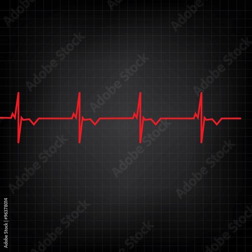 Ekg line