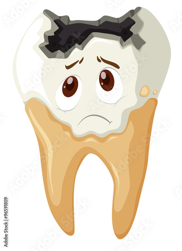 Tooth decay with sad face
