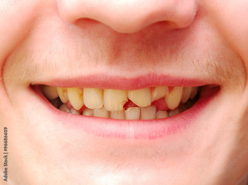 Naklejka premium dream of dentist