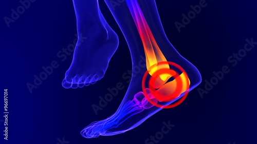 X-ray skeleton animation of ankle pain