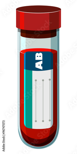 Blood sample in test tube