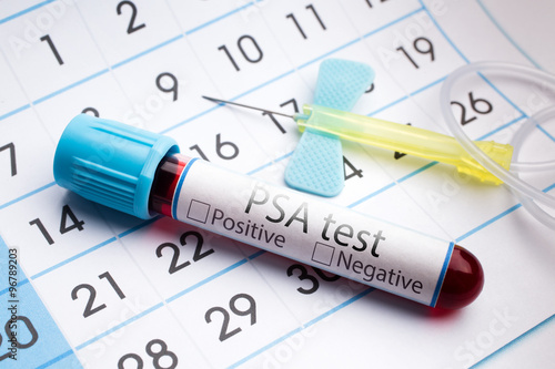 Blood test for analysis of PSA / blood sample in a tube with label PSA test on a monthly planner appointments