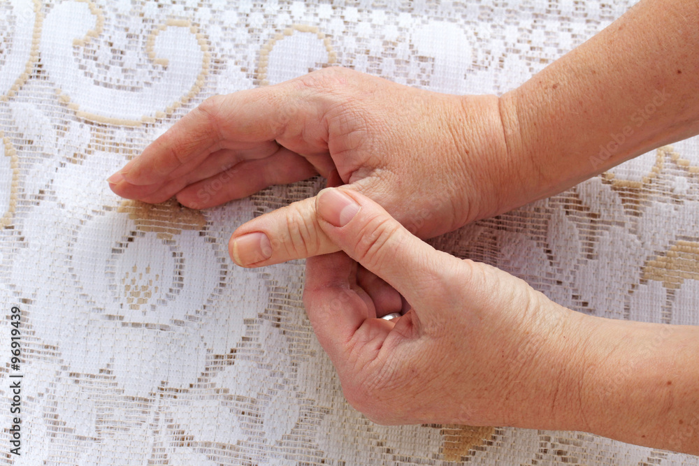Schmerzende geschwollene Finger und Hände StockFoto Adobe Stock