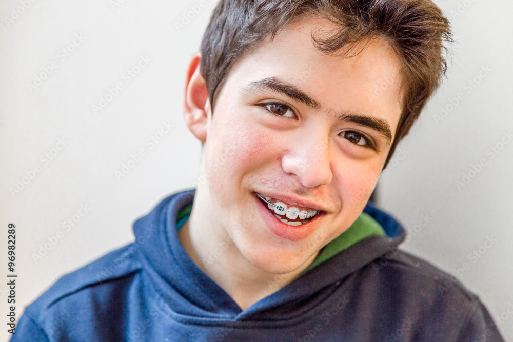 Boy smiling with braces Boy smiling with braces