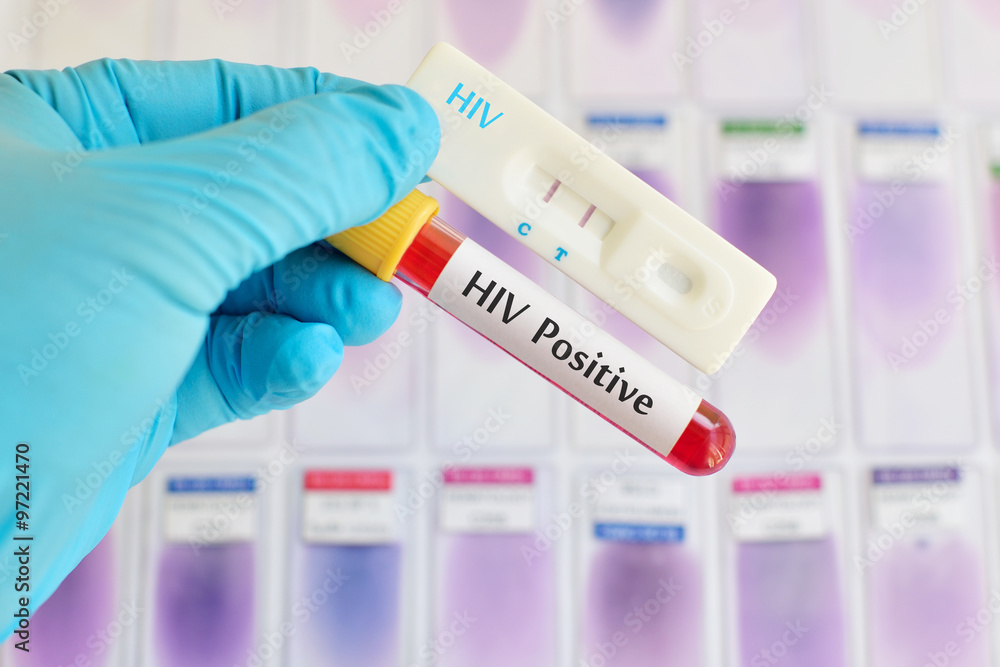HIV testing positive HIV testing positive