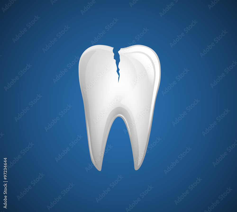 Obraz premium Dental Problem. Fractured and Chipped Teeth.