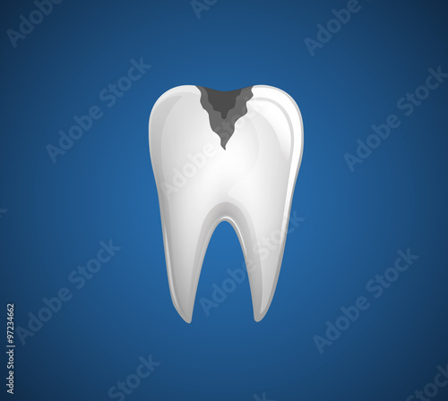 Dental Problem. Tooth with caries.