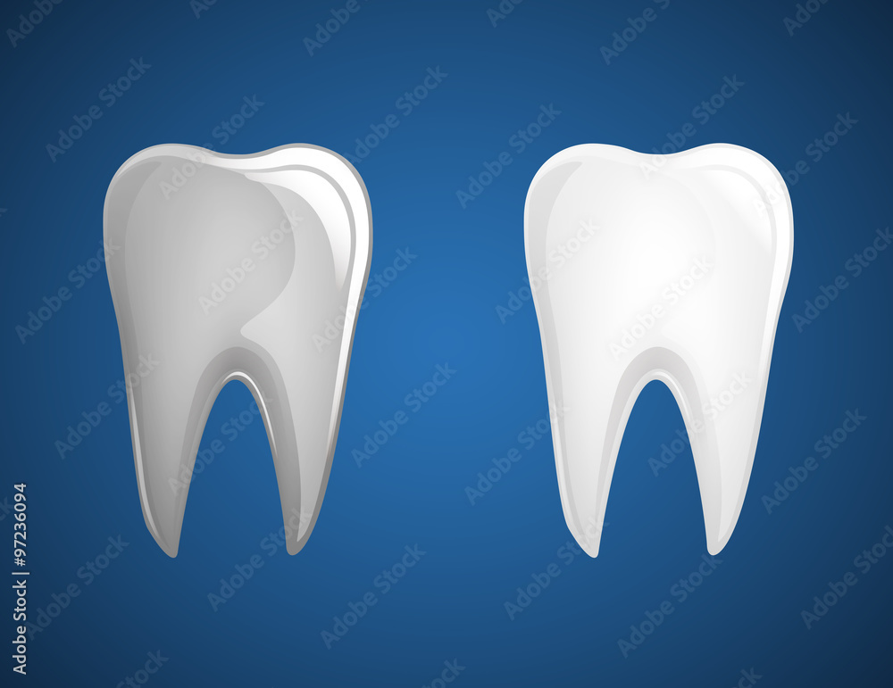 Teeth, tooth whitening set. Dental white evolution.