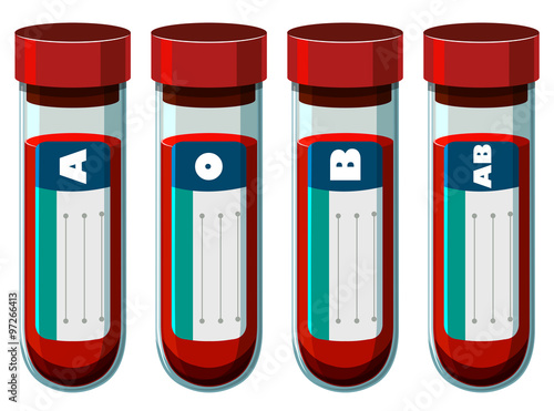 Different blood types in test tube