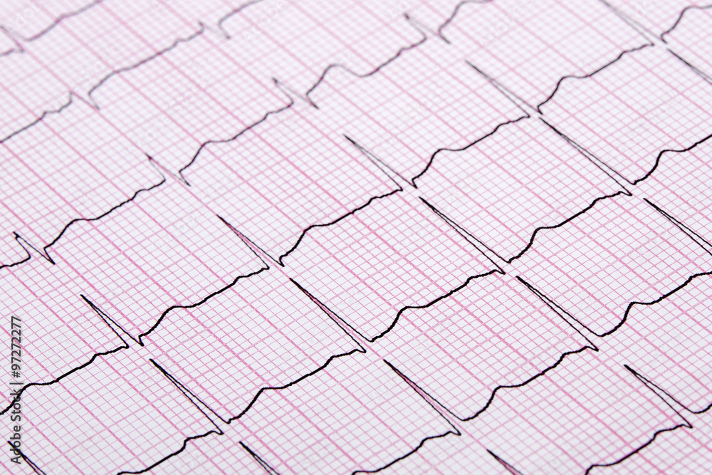 Close up of a Electrocardiograph also known as a EKG Close up of a Electrocardiograph also known as a EKG
