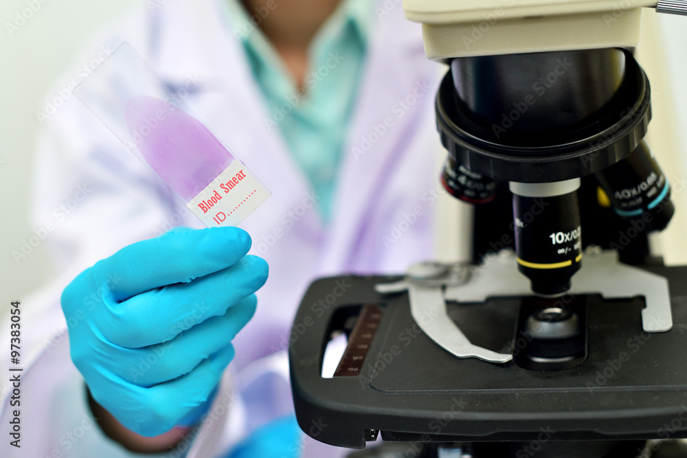Blood smear for hematology microscopic examination Stock Photo Adobe