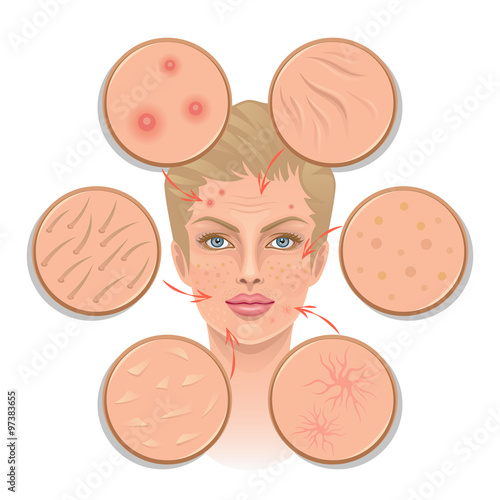Problems of skin