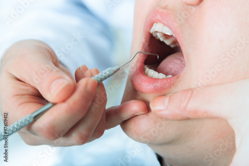 Close-up of patients open mouth during oral checkup with mirror near by