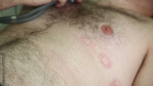 the doctor uses a stethoscope on the patient supine