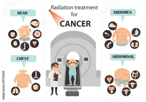 cervical cancer symptoms infographic.Vector illustration