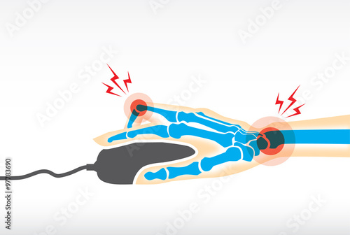 Symptom pain on hand and wrist because used mouse be a long time in working. This illustration about office syndrome and health care.
