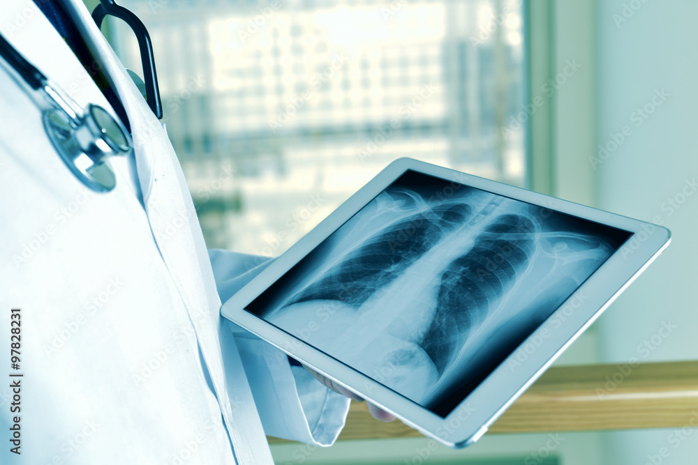 Φωτογραφία doctor observing a chest radiograph in a tablet
