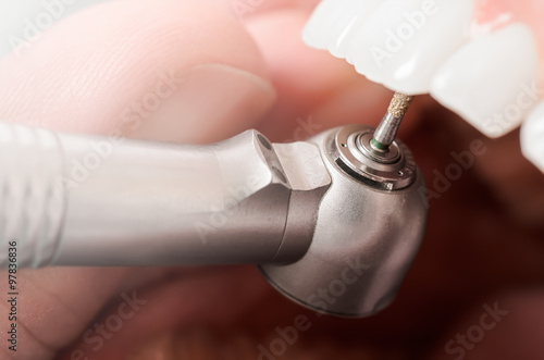 Wallpaper Mural Drilling the tooth - Close up Torontodigital.ca