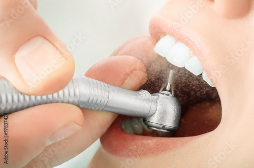 Close up of dentist hand drilling the teeth and spraying the water