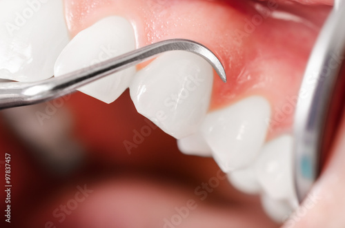 Comprehensive dental examination photo