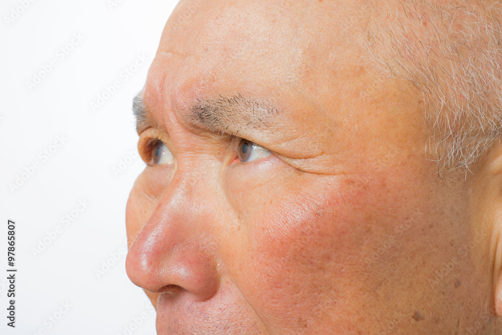 Obraz premium 怒り顔のシニア