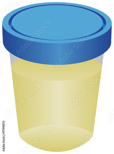 Container with urine for analysis