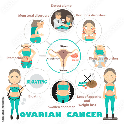 Symptoms of ovarian cancer in circles,info graphic vector illustration photo