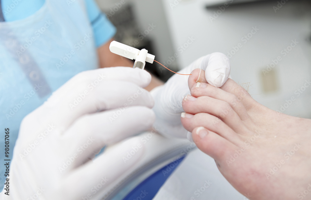 Rheumatism feet treatment by pedicure Rheumatism feet treatment by pedicure