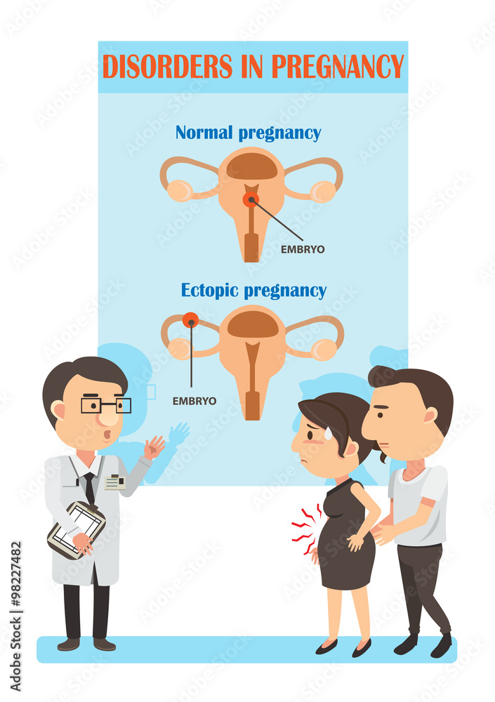 Doctor talking with patient Ectopic Pregnancy and Normal Pregnancy . Vector Illustration