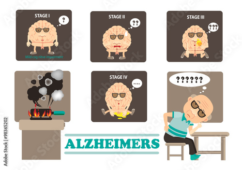 Stages of Alzheimers dementia  disease  info graphics.vector illustration photo