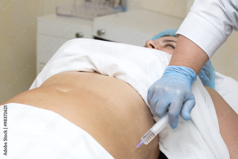 woman is in the process cellulite mesotherapy clinic woman is in the process cellulite mesotherapy clinic