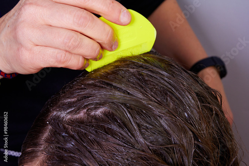 checking hair for lice