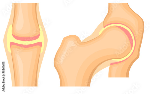 Hip joint structure