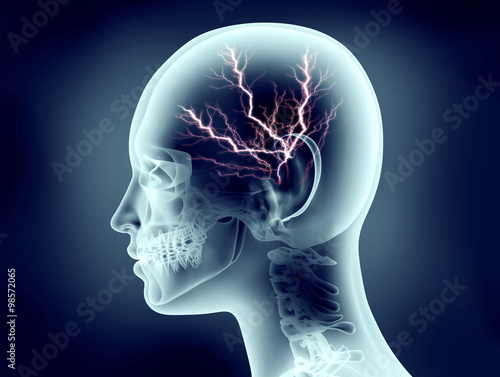 xray image of human head with lightning