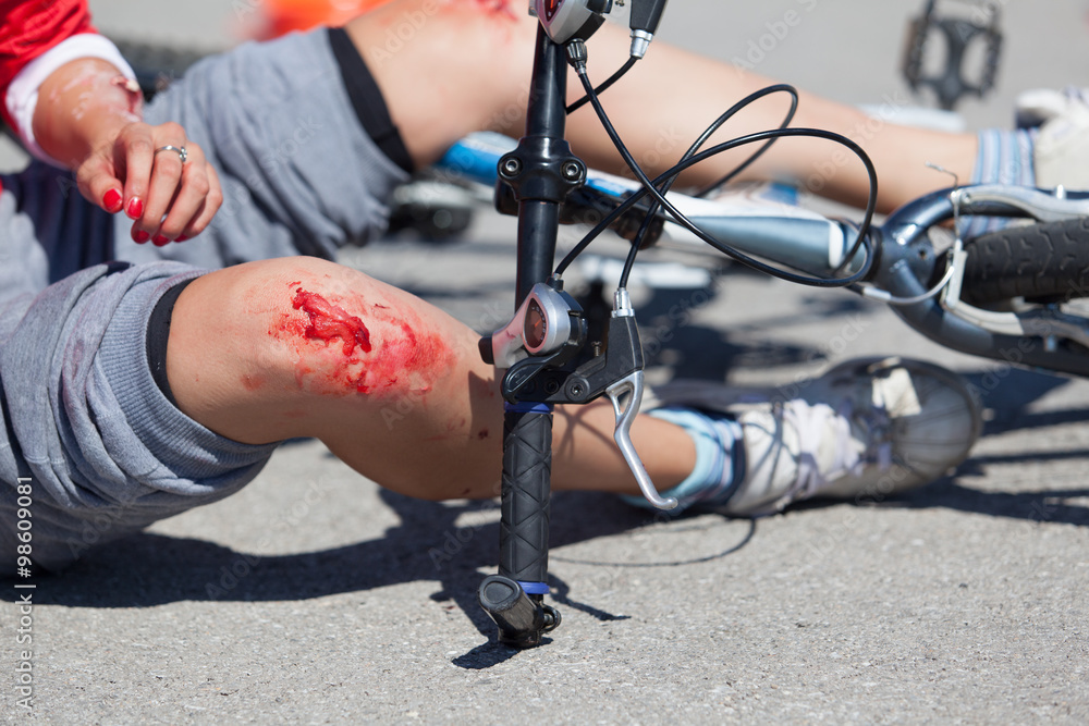 Bike fall injuries - obrazy, fototapety, plakaty 