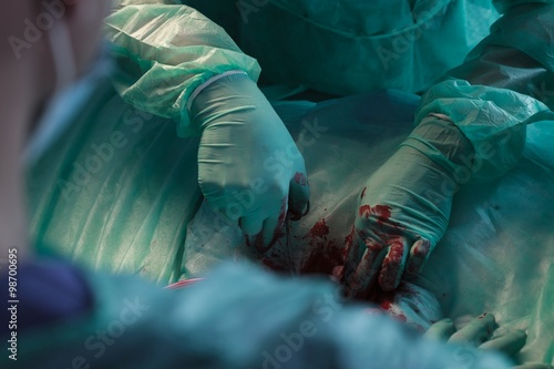 Surgeon's hands removing ailing tissue photo