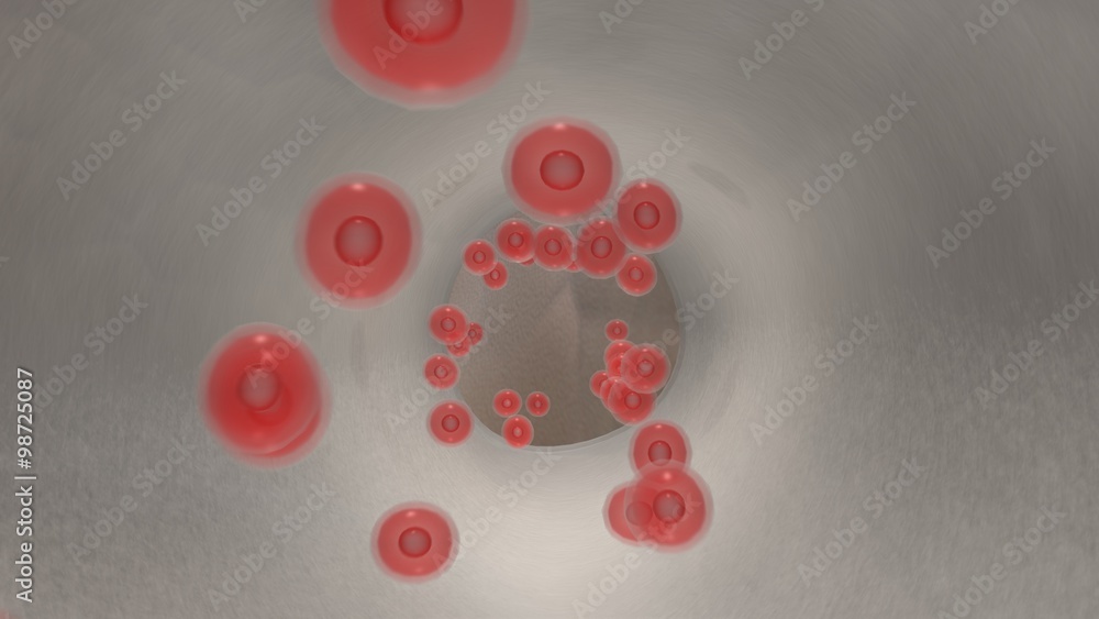 Endoscopic view of flowing red blood cells in a graft Stock ...