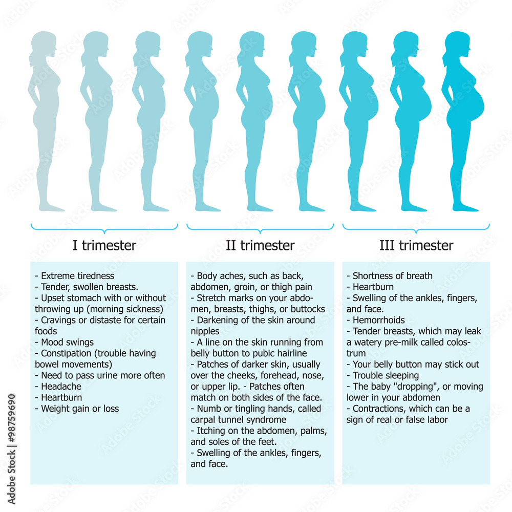 Infographic of pregnant woman in different period Stock Vector | Adobe