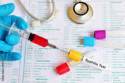 Blood sample for syphilis test photo