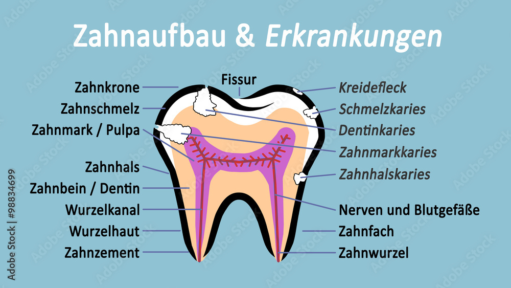 ts2 ToothSign Abbildung türkis Backenzahn im Schnitt Aufbau und Erkrankungen 16zu9 g4108