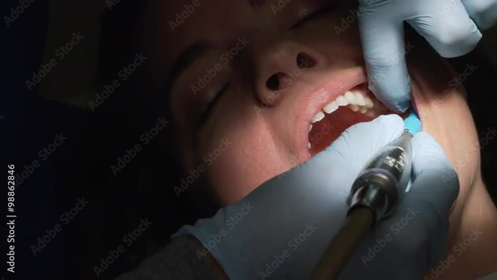 Dentist or dental hygienist carefully examines or cleans teeth of a woman. Dentist or dental hygienist carefully examines or cleans teeth of a woman.